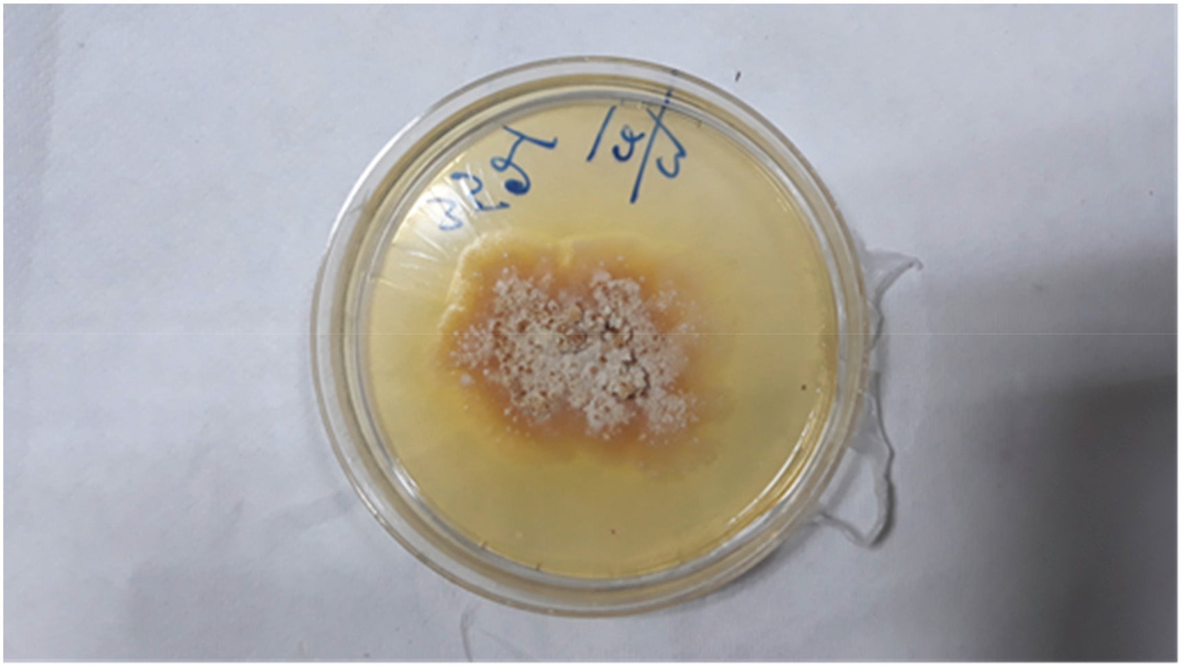 The man's fungal infection grown in a petri dish. (Photo: Soma Dutta, Ujjwayini Ray/Medical Mycology Case Reports)