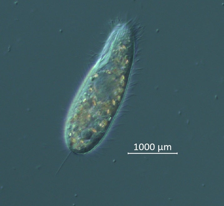 Mugshot: the microscopic species of ciliate believed to be behind the 2022 die-off. (Image: Mya Breitbart/USF College of Marine Science, Shutterstock)