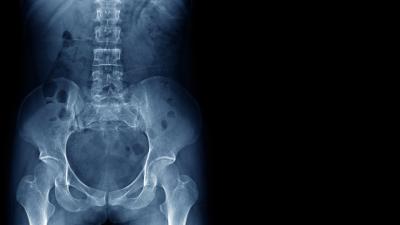 An Experimental Drug May Help Prevent Bone Loss in Space