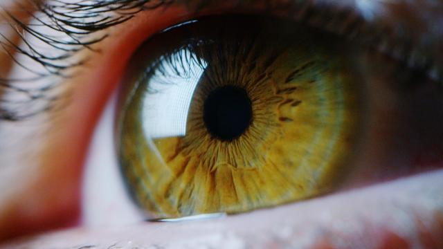 Man Gets Eye Exam, Learns He’s Had a Splinter Stuck in His Cornea for 15 Years