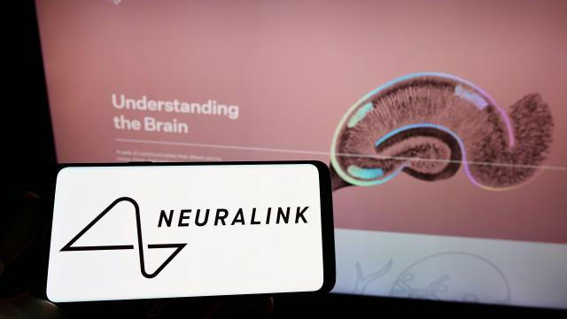 Elon Musk’s Brain Implant Company Neuralink Fined for ‘Hazardous Materials’ Violation
