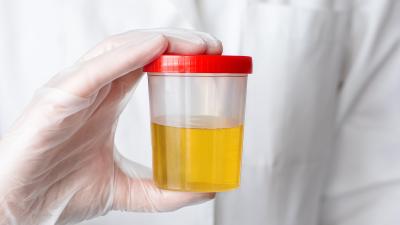 Urine Luck Because Scientists Figured Out Why Pee Is Yellow