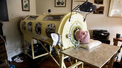 Man Who Lived in an Iron Lung Since 1953 Dies After Covid Diagnosis